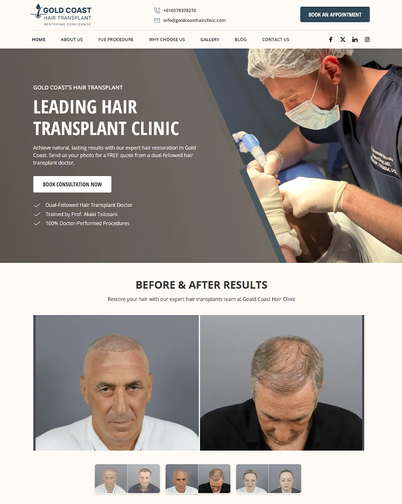 Hair transplant clinic website homepage showing hero section and before after treatment results